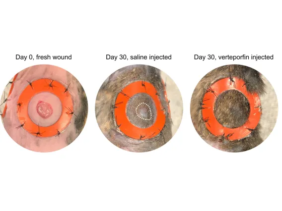 A test of verteporfin on wounds made on mice