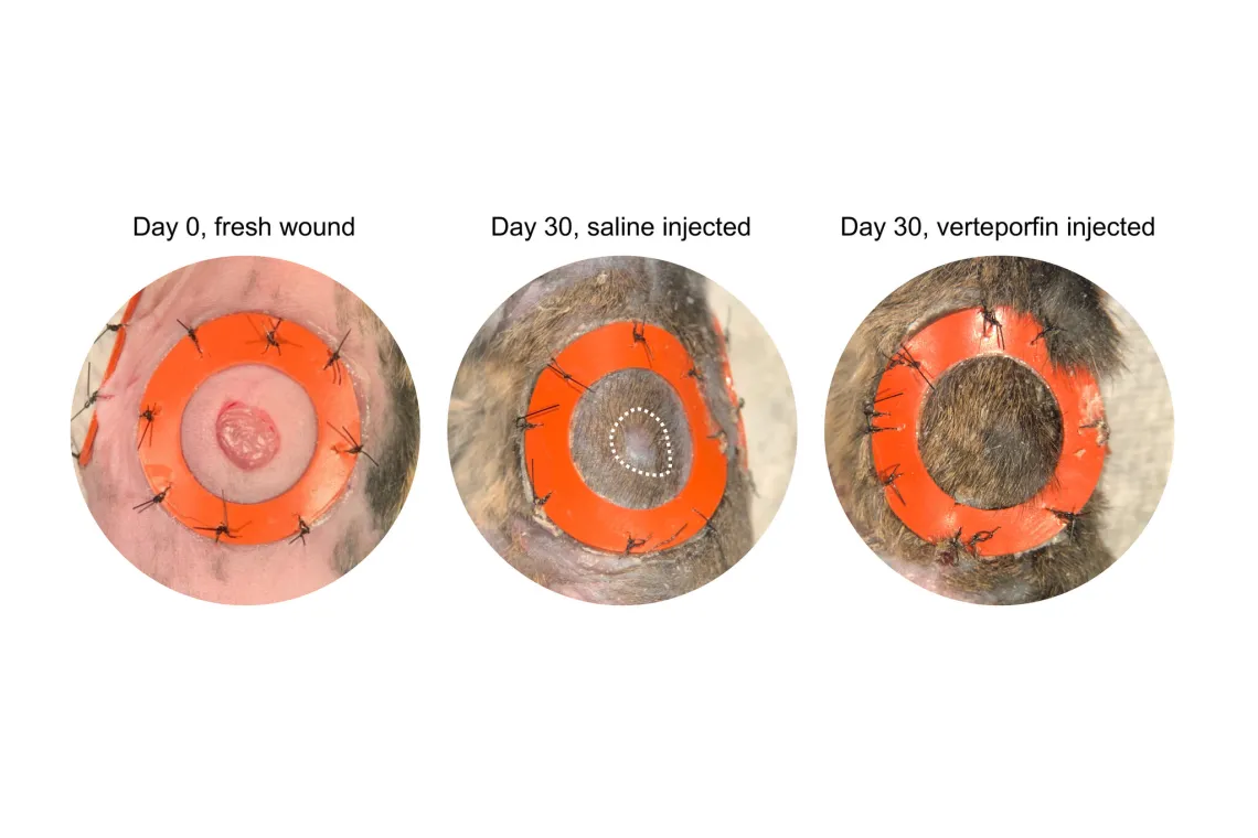 A test of verteporfin on wounds made on mice